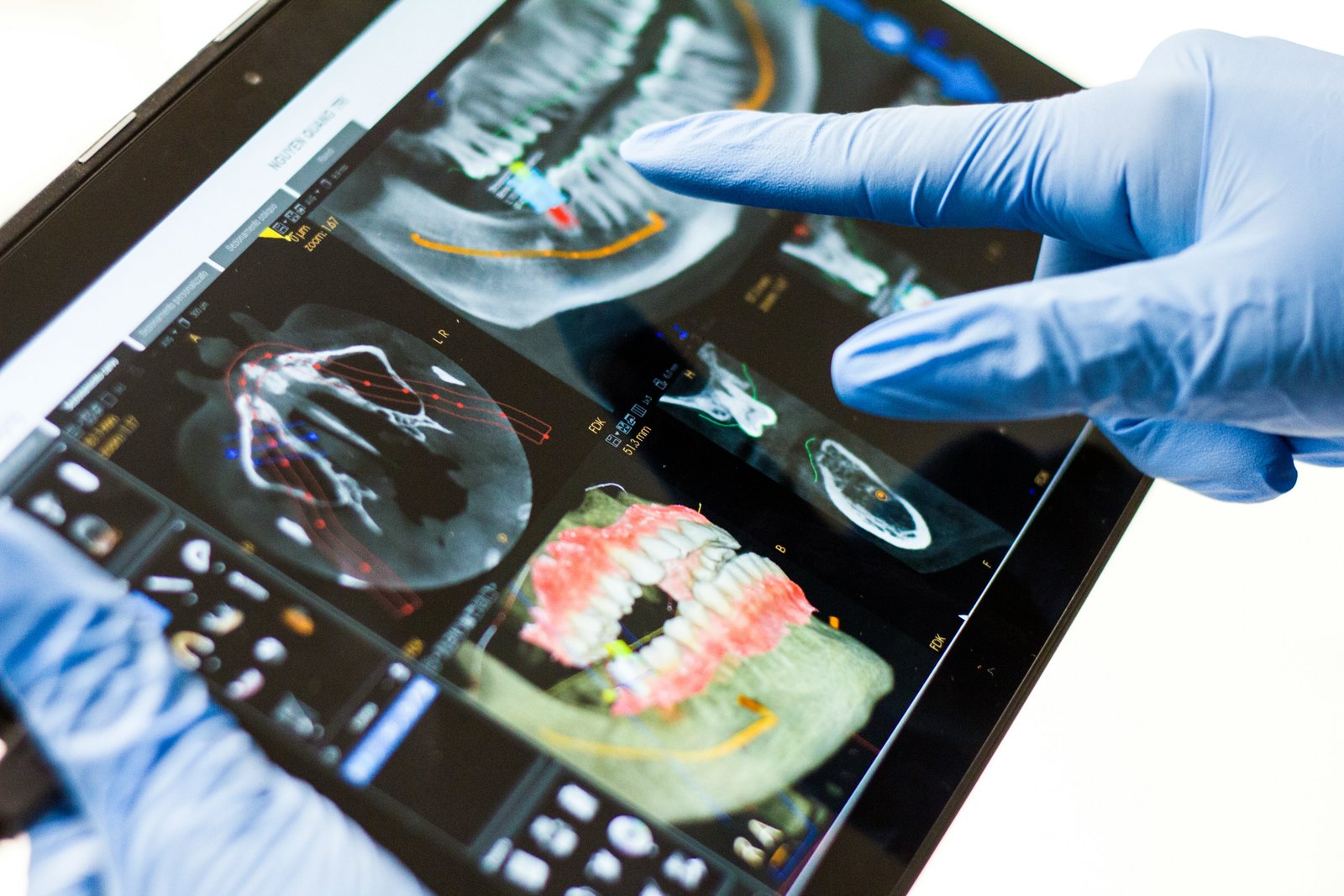 Advanced Imaging