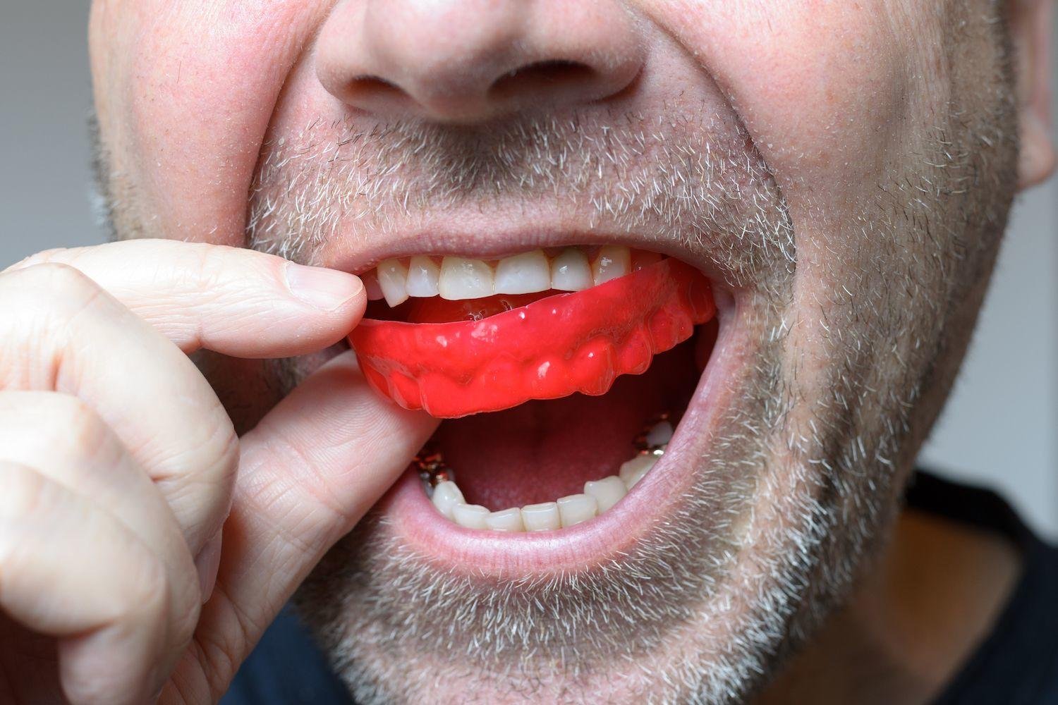 Bruxism Management