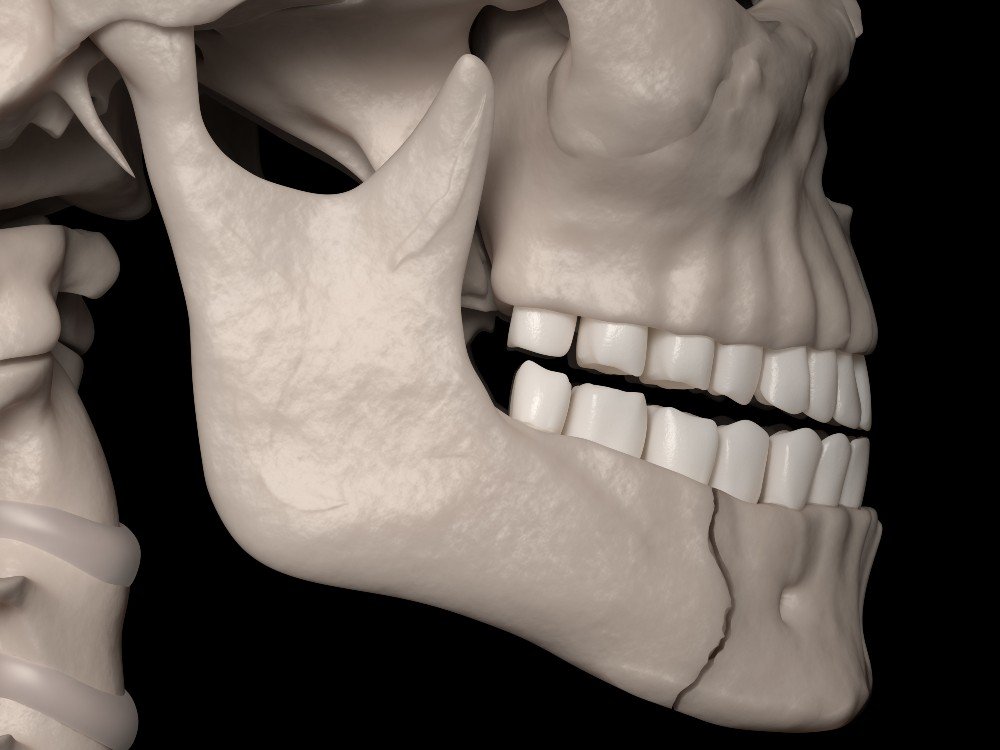Facial Trauma Surgery