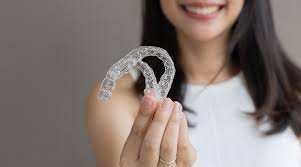 Custom Clear Aligners